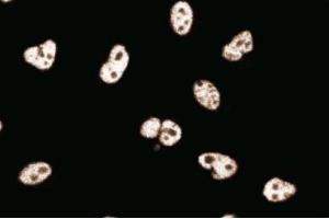 Human Endothelial (PPP1R10 antibody  (AA 605-716))
