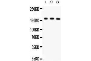 Anti- ABCB11 Picoband antibody, Western blotting All lanes: Anti ABCB11  at 0. (ABCB11 antibody  (C-Term))