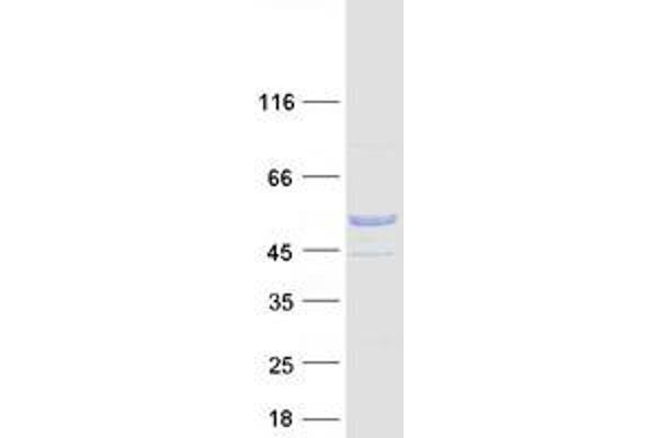 C9orf24 Protein (Transcript Variant 1) (Myc-DYKDDDDK Tag)