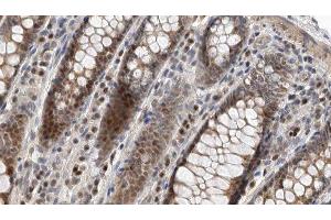 ABIN6275170 at 1/100 staining Rat colon tissue by IHC-P.