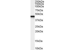 Western Blotting (WB) image for anti-Family with Sequence Similarity 65, Member A (FAM65A) (N-Term) antibody (ABIN2156859) (FAM65A antibody  (N-Term))