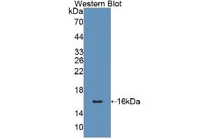 Detection of Recombinant CD7, Human using Polyclonal Antibody to Cluster Of Differentiation 7 (CD7) (CD7 antibody  (AA 26-134))