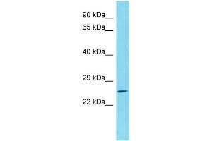 Host: Rabbit Target Name: C1orf105 Sample Type: HepG2 Whole Cell lysates Antibody Dilution: 1.