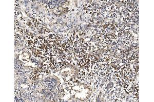 IHC analysis of DAP1/DAP using anti-DAP1/DAP antibody (ABIN7602875). (DAP antibody  (C-Term))