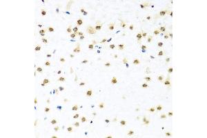 Immunohistochemistry of paraffin-embedded mouse brain using RAB3IP antibody at dilution of 1:100 (x40 lens). (RAB3IP antibody)