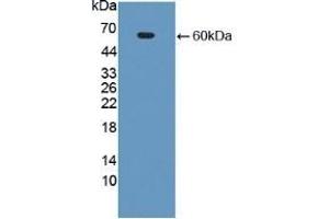 Detection of Recombinant CECR1, Human using Polyclonal Antibody to Cat Eye Syndrome Chromosome Region, Candidate 1 (CECR1) (CECR1 antibody  (AA 30-511))