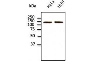 Endogenous CDH2 detected with at 1/500 dilution; lysates at 100 µg per lane and rabbit polyclonal to goat lgG (HRP) at 1/10,000 dilution.