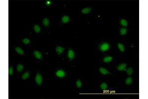 Immunofluorescence of monoclonal antibody to LASS4 on HeLa cell. (LASS4 antibody  (AA 57-139))