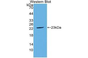 Western blot analysis of the recombinant protein. (FGF21 antibody  (AA 29-209))