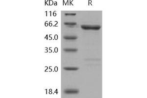 TNK2 Protein (GST tag)