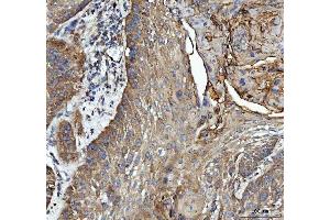 IHC analysis of GRB10 using anti-GRB10 antibody (ABIN7599160).
