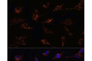 Immunofluorescence analysis of C6 cells using TGFB1 Polyclonal Antibody at dilution of 1:100. (TGFB1 antibody)