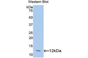 Western Blotting (WB) image for anti-Chemokine (C-C Motif) Ligand 24 (CCL24) (AA 27-119) antibody (ABIN1078373) (CCL24 antibody  (AA 27-119))