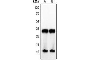 Western blot analysis of IL-4 expression in Jurkat (A), human tonsil (B) whole cell lysates. (IL-4 antibody  (Center))