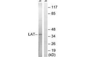 Western blot analysis of extracts from Jurkat cells, using LAT (Ab-161) Antibody.