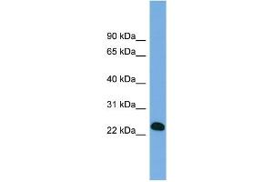 WB Suggested Anti-BCL7A Antibody Titration: 0. (BCL7A antibody  (Middle Region))