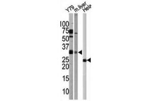 Western Blotting (WB) image for anti-ATG5 Autophagy Related 5 (ATG5) antibody (ABIN2999976)