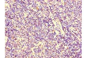 Immunohistochemistry of paraffin-embedded human lymph node tissue using ABIN7156118 at dilution of 1:100 (KPNA2 antibody  (AA 2-285))