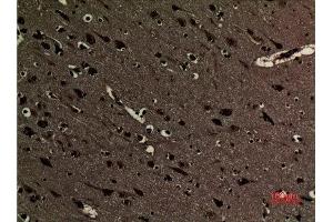 Immunohistochemistry (IHC) analysis of paraffin-embedded Human Brain, antibody was diluted at 1:100.