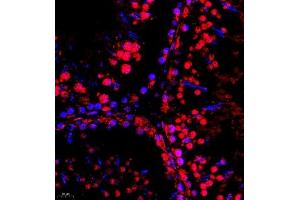 Immunofluorescence of paraffin embedded rat testis using SR140 (ABIN7076091) at dilution of 1:600 (400x lens) (SR140 antibody)