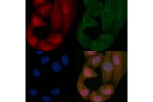 p53 Mouse Monoclonal Antibody staining Hela cells by IF/ICC. (p53 antibody  (Internal Region))
