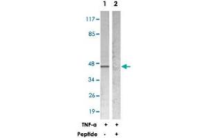 Western blot analysis of extracts from HeLa cells treated with TNF-a (20 ng/mL 5 min), using NFKBIE polyclonal antibody .