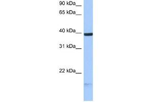 HS3ST5 antibody used at 0. (HS3ST5 antibody)