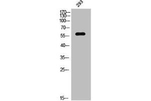 Western Blot analysis of 293 cells using Phospho-PAKγ (S20) Polyclonal Antibody (PAK2 antibody  (pSer20))