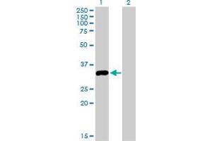 Western Blot analysis of STK16 expression in transfected 293T cell line by STK16 monoclonal antibody (M03), clone 2G6. (STK16 antibody  (AA 1-100))