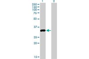 Western Blot analysis of STK16 expression in transfected 293T cell line by STK16 monoclonal antibody (M03), clone 2G6.
