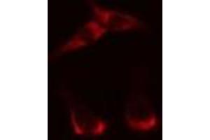 ABIN6269295 staining HepG2? (14-3-3 zeta antibody  (Internal Region))