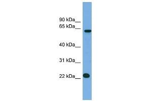 C21ORF45 antibody used at 1 ug/ml to detect target protein. (C21ORF45 antibody  (N-Term))