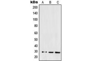 Western blot analysis of SNAI1 expression in HEK293 (A), NCIH460 (B), Caki1 (C) whole cell lysates. (SNAIL antibody  (C-Term))
