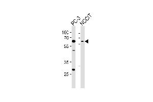 Western blot analysis of lysates from PC-3, NCCIT cell line (from left to right), using TBX22 Antibody (C-term) (ABIN6243313 and ABIN6577614). (T-Box 22 antibody  (C-Term))
