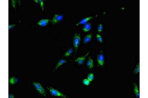 Immunofluorescent analysis of Hela cells using ABIN7170549 at dilution of 1:100 and Alexa Fluor 488-congugated AffiniPure Goat Anti-Rabbit IgG(H+L) (SMS antibody  (AA 16-191))