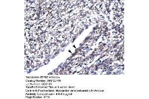 Human Heart (ZBTB7B antibody  (Middle Region))