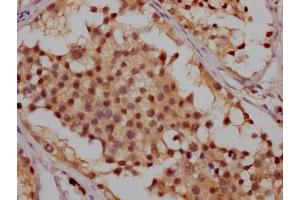 IHC image of ABIN7127351 diluted at 1:100 and staining in paraffin-embedded human testis tissue performed on a Leica BondTM system. (Recombinant ATM antibody)