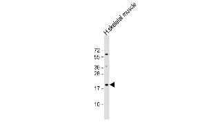 Anti-IP1L Antibody (C-term) at 1:1000 dilution + human skeletal muscle lysate Lysates/proteins at 20 μg per lane.