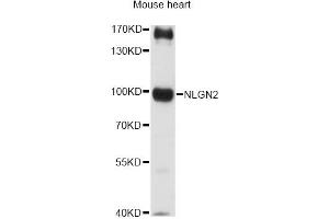 Western blot analysis of extracts of mouse heart, using NLGN2 antibody (ABIN6290687) at 1:3000 dilution. (Neuroligin 2 antibody)