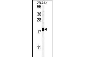 SDHAF1 Antibody (Center) (ABIN651585 and ABIN2840312) western blot analysis in ZR-75-1 cell line lysates (35 μg/lane). (SDHAF1 antibody  (AA 34-62))