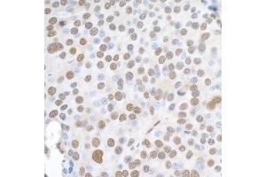 Immunohistochemistry (IHC) image for anti-Heterogeneous Nuclear Ribonucleoprotein K (HNRNPK) (C-Term) antibody (ABIN7454660) (HNRNPK antibody  (C-Term))