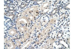 C14ORF130 antibody was used for immunohistochemistry at a concentration of 4-8 ug/ml to stain Epithelial cells of renal tubule (arrows) in Human Kidney. (UBR7 antibody  (C-Term))