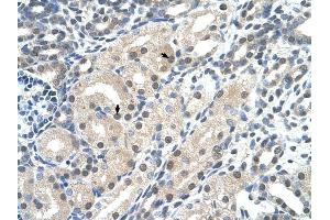 C14ORF130 antibody was used for immunohistochemistry at a concentration of 4-8 ug/ml to stain Epithelial cells of renal tubule (arrows) in Human Kidney. (UBR7 antibody  (C-Term))