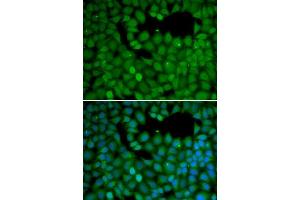 Immunofluorescence (IF) image for anti-Neuroepithelial Cell Transforming 1 (NET1) (AA 1-300) antibody (ABIN6215710) (NET1 antibody  (AA 1-300))