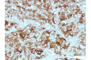 Formalin-fixed, paraffin-embedded Adrenal Gland stained with Chromogranin A Monoclonal Antibody (CGA/413+ CHGA/777+ CHGA/798)