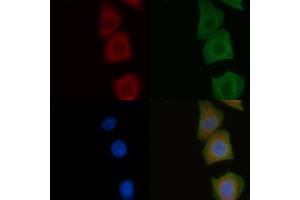 ABIN6258141 and ABIN6275933 staining Hela cells by IF/ICC.