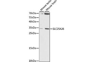 Western blot analysis of extracts of various cell lines, using SLC25 antibody (ABIN7270437) at 1:1000 dilution. (SLC25A26 antibody  (AA 105-185))