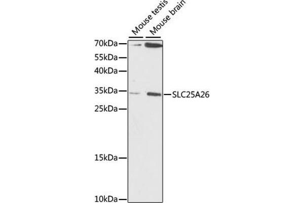 SLC25A26 antibody  (AA 105-185)