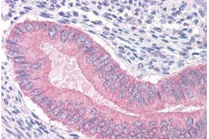 Human Uterus: Formalin-Fixed, Paraffin-Embedded (FFPE) (CTNNA1 antibody  (AA 871-883))