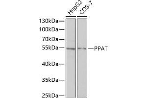 Western blot analysis of extracts of various cell lines, using PPAT antibody (ABIN6128488, ABIN6146009, ABIN6146010 and ABIN6222409) at 1:1000 dilution. (PPAT antibody  (AA 1-280))